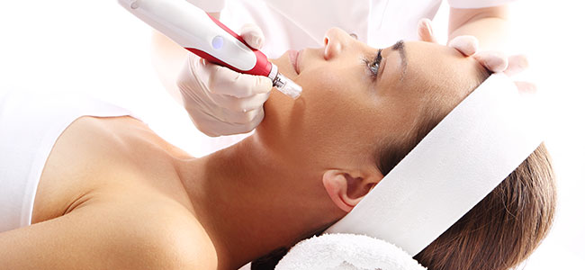 Microneedling bei Dr. Verena Beck